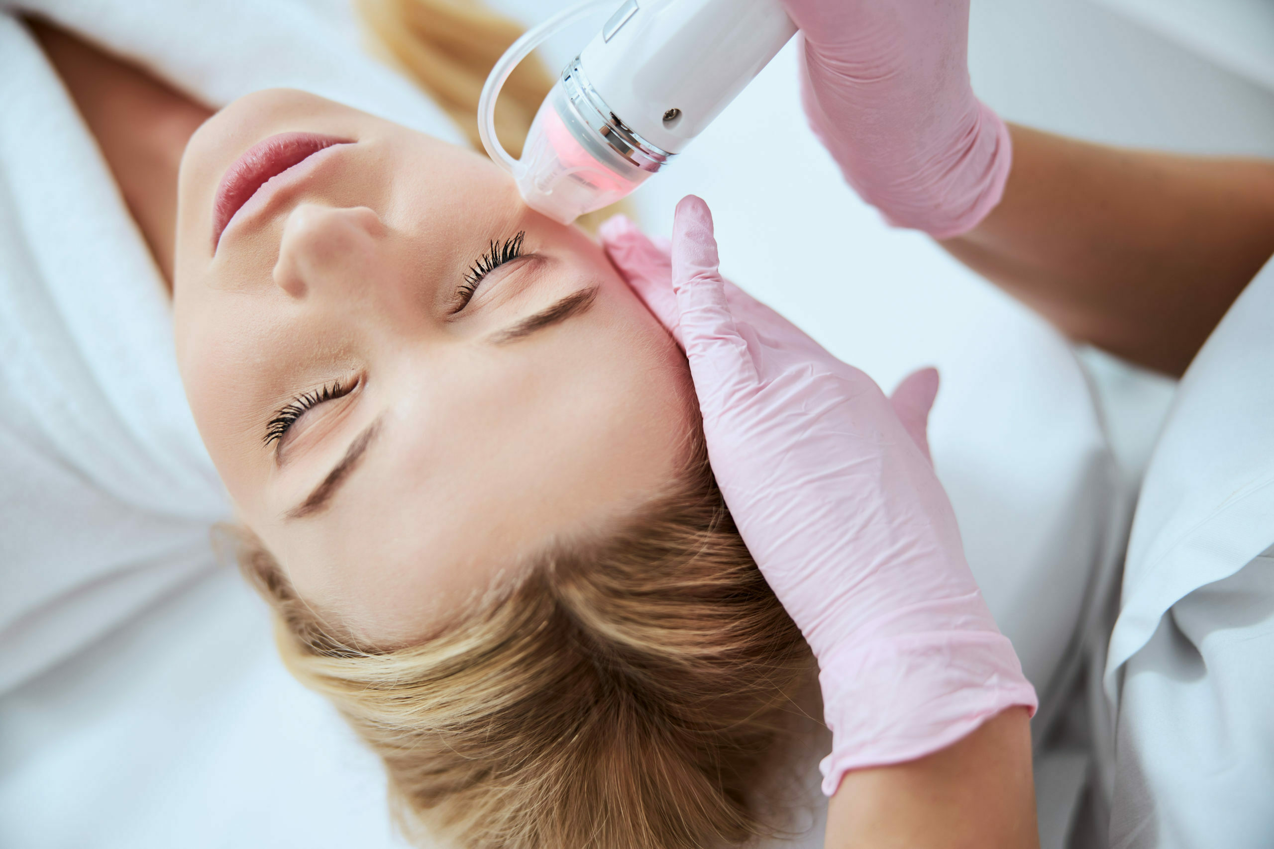 Microneedling services available at Mind and Body Medspa In Versailles, Kentucky