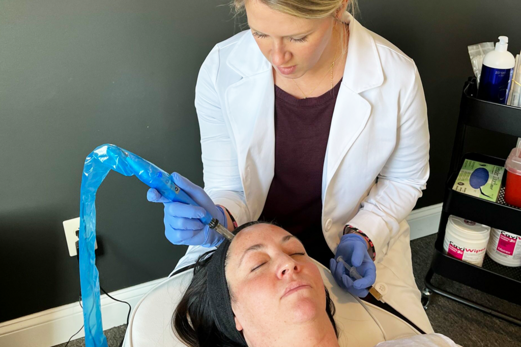 Microneedling at mind and body medical spa in versailles, kentucky