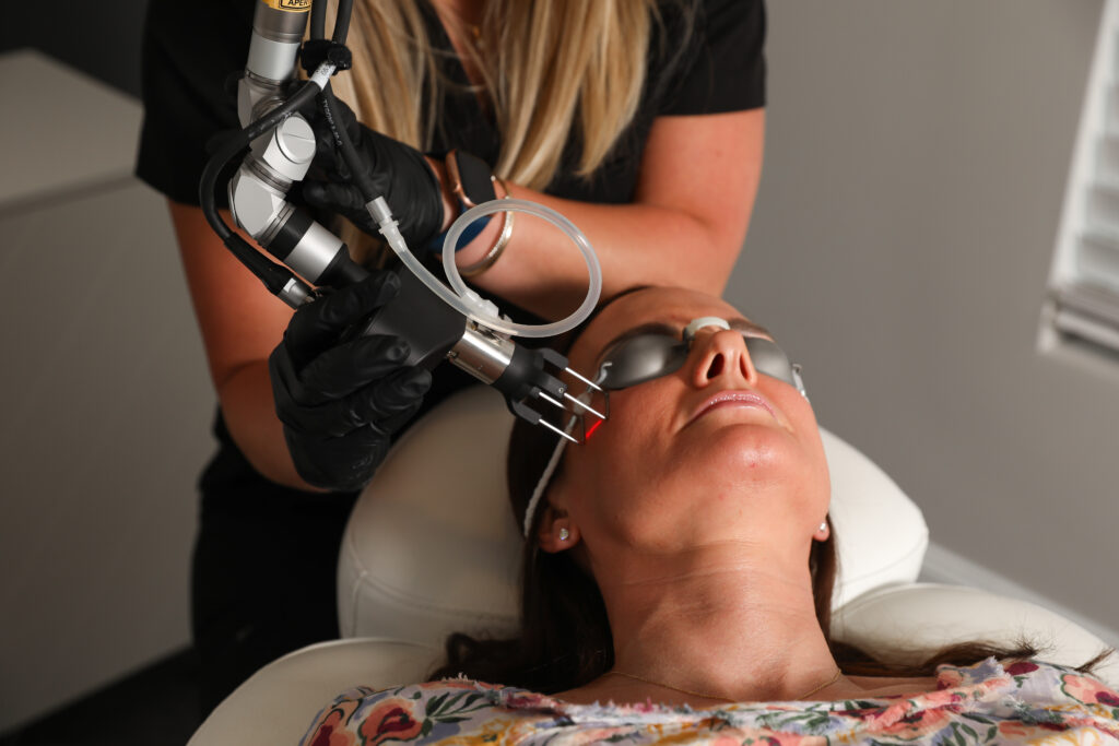 Medical Spa In Versailles, KY-Co2 Laser Treatment in Versailles, KY